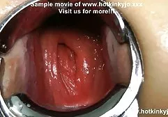 肛交与魅力之美